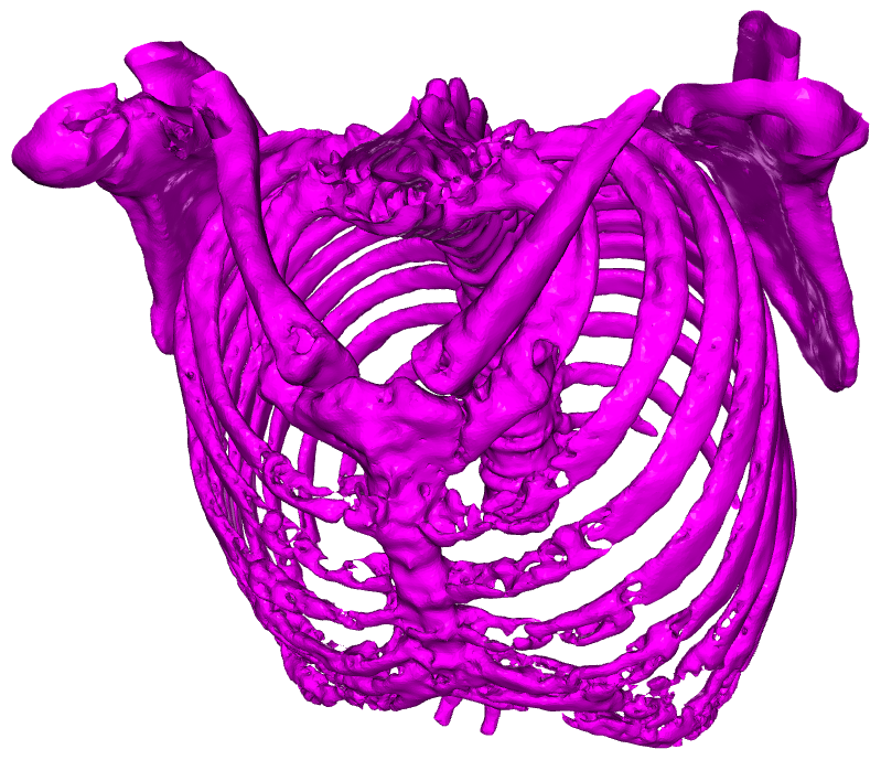 Mesh of sceleton
