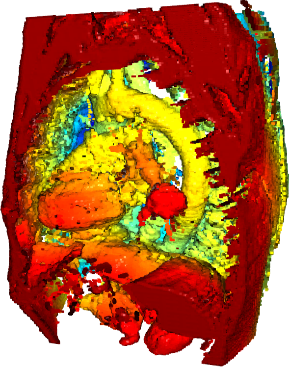 Point cloud of torso
